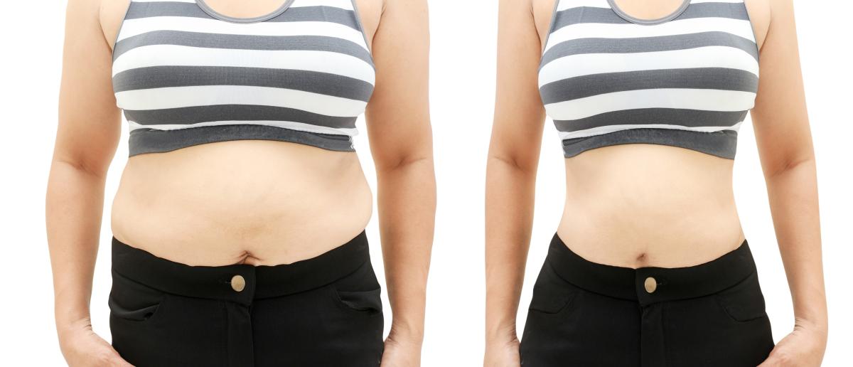 40代女性のお腹が出る原因について京都四条烏丸のA BODYが解説します！
その腹筋運動はムダかも、、、
40代女性のお腹が出る原因｜姿勢と呼吸を整えないと腹筋しても残念ながら解決しません